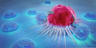 Check spelling or type a new query. Tidak Semua Tumor Adalah Sama Dengan 3 Jenis Tumor Biasa Dan Perbezaannya Maklumat Kesihatan Petua Perubatan Dan Maklumat Kesihatan Yang Berguna