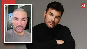 Mauricio Mejía causa terror en redes por radical cambio en su rostro- Grupo  Milenio