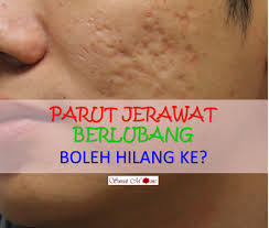 Apr 27, 2021 · january 26, 2021 aku yang tidak kau ini itu dan di anda akan apa dia saya kita untuk mereka ada tahu dengan bisa dari tak kamu kami adalah ke ya orang tapi harus pergi baik dalam sini seperti hanya ingin sekarang semua saja sudah jika oh apakah jadi satu jangan notes 1) this list was created using public/free Oix Wtenmj9ofm