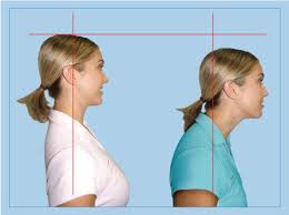 Pin On How To Fix Forward Head Posture