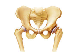 Loss and damage resulting from use. Osteoarthritis Treatment In Malaysia Yck Pain Treatment Centre