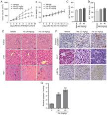 Wir sehen mit den augen und hören mit den ohren. Hispidulin Exhibits Potent Anticancer Activity In Vitro And In Vivo Through Activating Er Stress In Non Small Cell Lung Cancer Cells