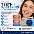 Professional teeth whitening at Shreedant Dental Clinic