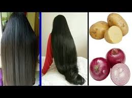How Long Hair Grows And Thicken With Onions And Potatoes Super Fast Hair Growth Challenge In 2020 Super Fast Hair Growth Hair Growth Challenge Extreme Hair Growth