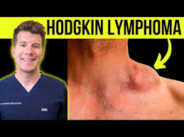 Image result for Lymphoma