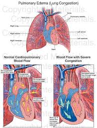 Pin On Cardiology