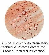 Could Adaptable Bacteria Cause Repeat Urinary Tract Infections Webmd