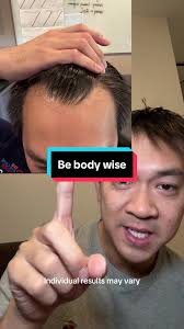 Jonathan Le Dr Ribeyes