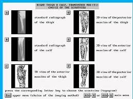 Their main function is contractibility. Thigh Anatomy Mri Anatomy Drawing Diagram