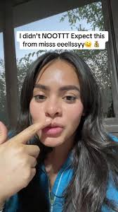 Daisy Accident Murillo Twin