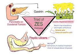 Zollinger Ellison Syndrome Zes Creative Med Doses