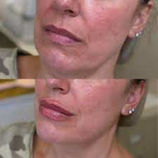 Voted Best of Monroe County @magnoliasmedspa 🤩 Thank you to everyone who  voted for us! We are truly honored to be recognized in so many categories!  I myself am so honored and