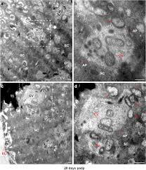 Detection and characterization of rice orange leaf phytoplasma infection in  rice and Recilia dorsalis