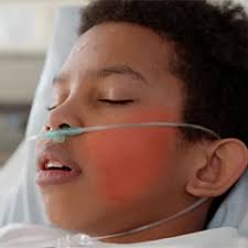 MIS-C Declining Cases Risk