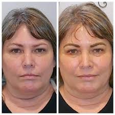 Veronica M. Morris at Rise and Shine Permanent Makeup is at Veronica M.  Morris at Rise and Shine Permanent Makeup.