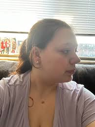 why am i losing fat everywhere but my stomach?