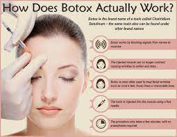 Maybe you would like to learn more about one of these? How Long For Botox To Work Arxiusarquitectura