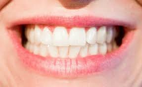 como clarear os dentes com oito metodos caseiros bruxismo branqueamento de dentes natural dentes saudaveis