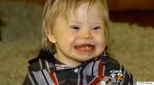 Dad Of Son With Down Syndrome Says He Was Fired For Asking Coworkers Not To  Say The R-Word