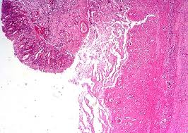 Image result for Entada bacillaris