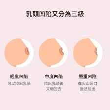 乳頭凹陷會怎樣?學會3招依然可以順利哺乳! - mamaway