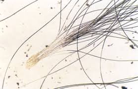 Hair under a stereo microscope. Fbi Forensic Science Communications July 2004
