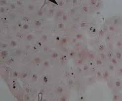The process of mitosis consists of the following stages or phases Microscopy