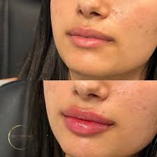 𝗧𝗥𝗨𝗘 𝗘𝗦𝗦𝗘𝗡𝗖𝗘 𝗔𝗲𝘀𝘁𝗵𝗲𝘁𝗶𝗰𝘀 (@trueessenceaesthetics) •  Threads, Say more