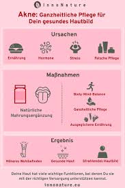 Akne Diese Formen Gibt Es Und Das Kannst Du Gegen Die Lastigen Pickel Tun In 2020 Akne Was Hilft Gegen Pickel Hausmittel Gegen Unreine Haut