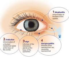 Image result for Blepharis bainesii