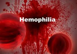 Type a, which is a deficiency in factor viii, and type b, also known as christmas disease, which is a deficiency in factor ix. Hemophilia Awareness Uk Home Facebook