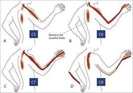 It's painful if it presses on nerves. Tanda Tanda Sakit Dan Darul Huffaz And Slip Disc Asia Facebook