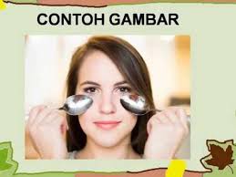 Es batu juga seringkali dijadikan cara cepat mengatasi kantung mata karena mudah didapatkan di mana saja. Hanya Pakai Sendok Kantung Mata Bisa Hilang Ini Tipsnya Bagi Si Mata Panda Youtube