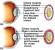 Ciliary Process