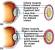 Ciliary Process