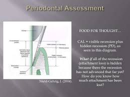 Perio Assessment