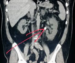Pin On Ct Scans