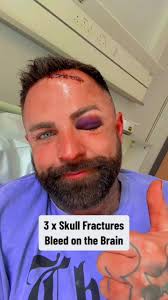 102_one night that changed everything but I am stronger than ever 🦍 #fyp  #motivation #fo