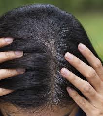 Start at the back of your head and read the instructions thoroughly to determine how long you should leave the bleach on. 20 Simple Ways To Cover Gray Hair Naturally At Home