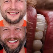 Mnogo bolje, šta vi mislite? I ovaj put