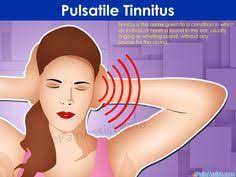 Pulsatile Tinnitus Tinnitus Remedies Tinnitus Symptoms Ear