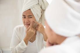 Gel lidah buaya menghasilkan pelembab yang juga menenangkan bekas jerawat pada remaja. Cara Menghilangkan Jerawat Dari Obat Hingga Alami