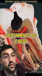 amil dental e700 & amil dental e700 cobre implante ...| Kwai