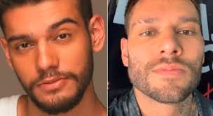 Lucas lima ретвитнул(а) comentarios sinceros do craque neto. O Que Deu Errado Na Harmonizacao Facial De Lucas Lucco