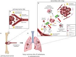 The best way to increase a dog's prognosis against metastatic cancer is to be aware of the signs and to detect it early enough that treatment can be successful. Frontiers Understanding And Modeling Metastasis Biology To Improve Therapeutic Strategies For Combating Osteosarcoma Progression Oncology