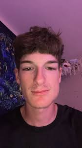 In-office teeth whitening options