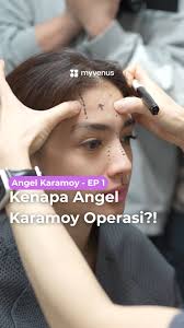 Angel Karamoy Glow-Up di Korea! 🇰🇷✨, Angel Karamoy menjalani transformasi  wajah di Korea bareng @myvenus.io! 💖 Dari konsultasi sampai operasi,  semuanya didampingi biar hasilnya maksimal! 😍, ✨ Prosedur ...