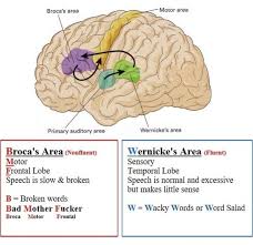 Broca S Vs Wernicke S Aphasia Surgical Nursing Nursing Tips