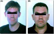 Table of Contents page: The American Journal of Medicine