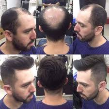 Hair weaves can both improve a hairdo or offer a totally different appearance. Hair Weaving Techniques And Its Amazing Benefits